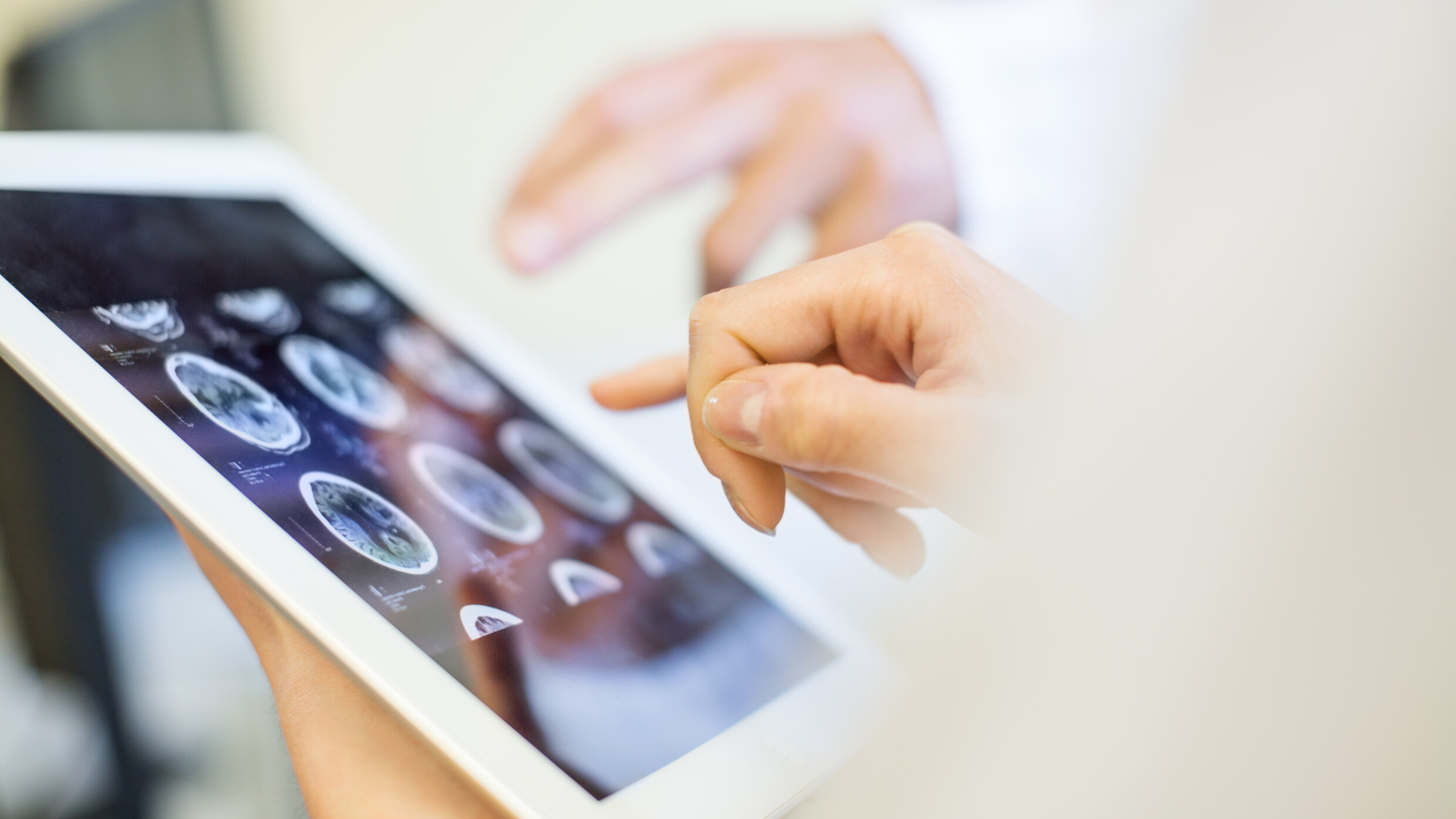 MRI images on a tablet